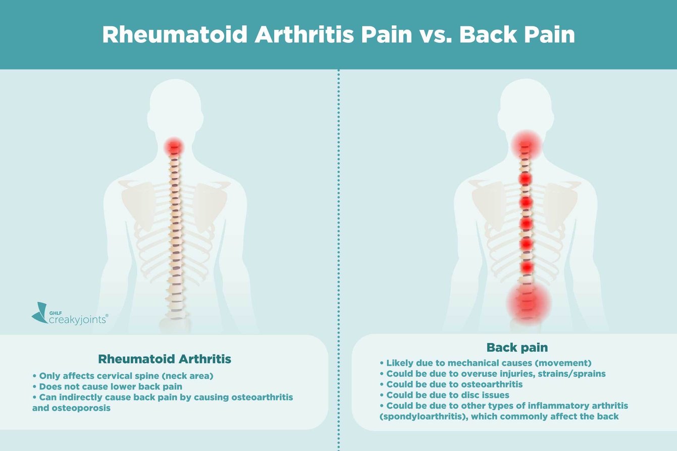 A Patient’s Guide to Understanding Rheumatoid Arthritis Pain