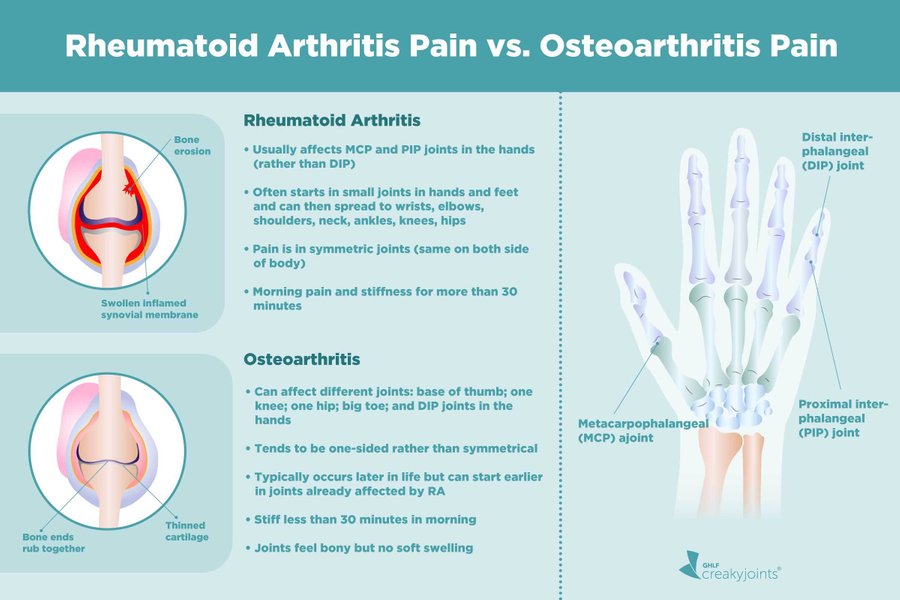 A Patient s Guide To Understanding Rheumatoid Arthritis Pain