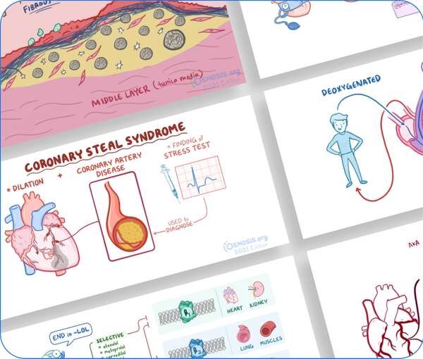 Medical Illustrated Video Explainers For Teaching Students | Osmosis