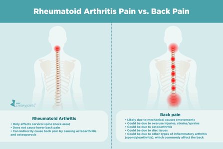 A Patient’s Guide to Understanding Rheumatoid Arthritis Pain