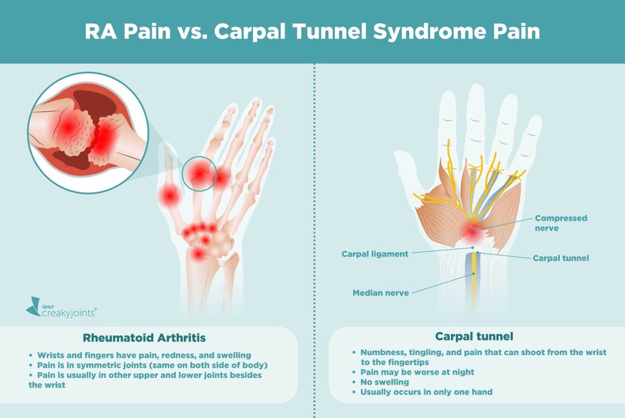 A Patient’s Guide to Understanding Rheumatoid Arthritis Pain