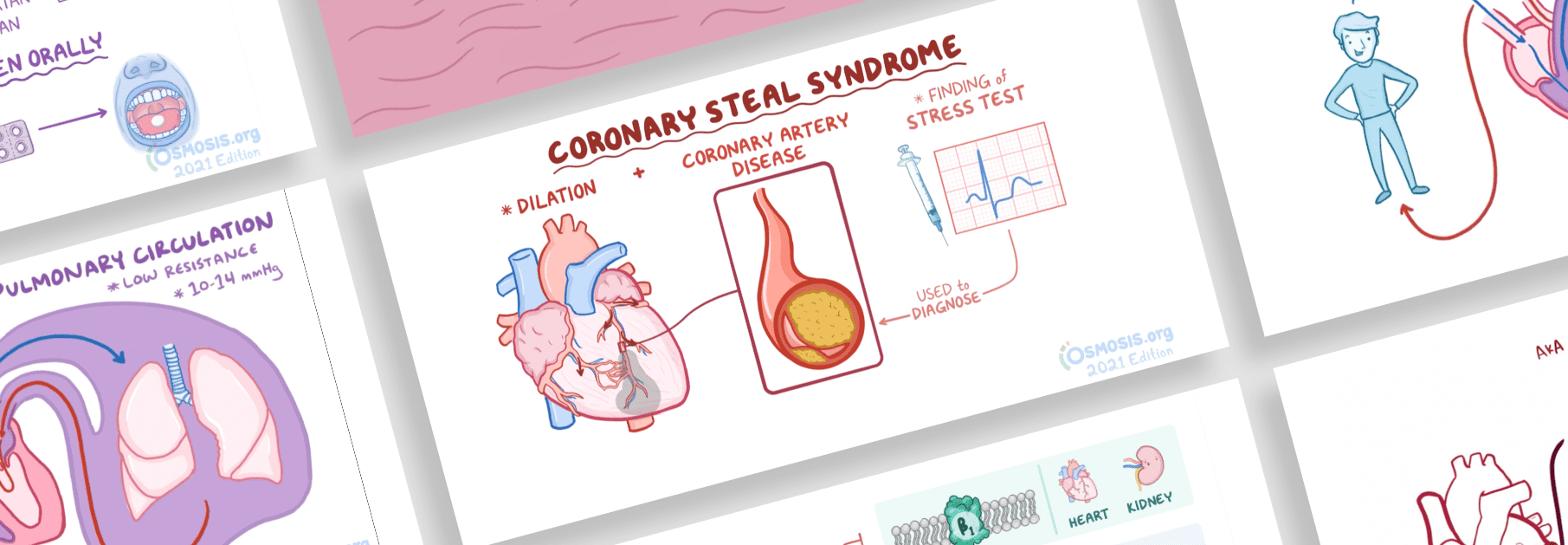 Medical Illustrated Video Explainers For Teaching Students | Osmosis