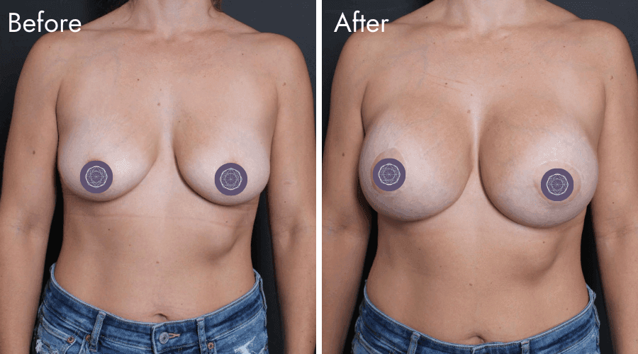 patient 9 before after