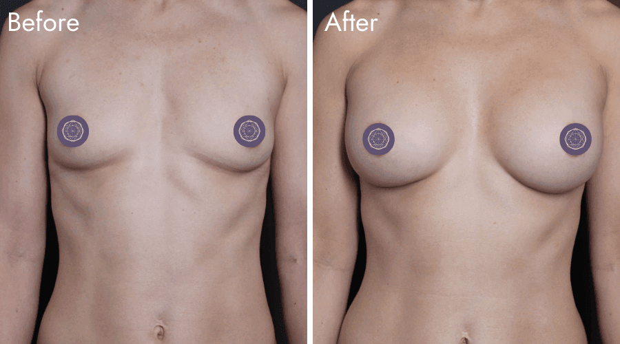 patient 1 before after