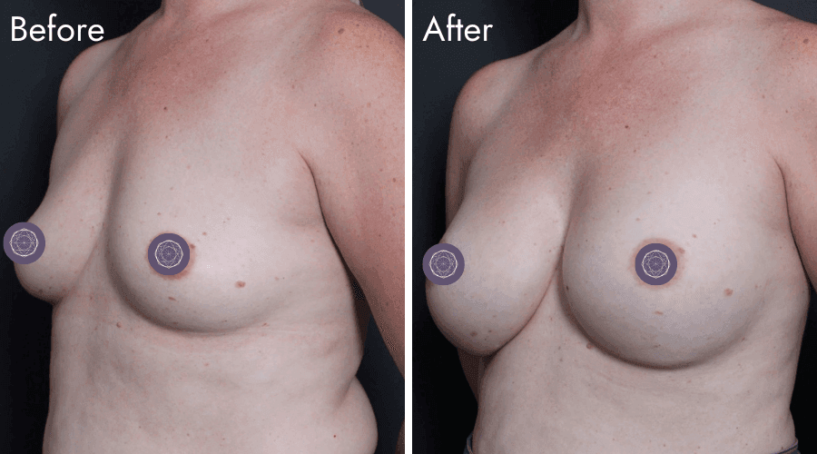 patient 2 before after