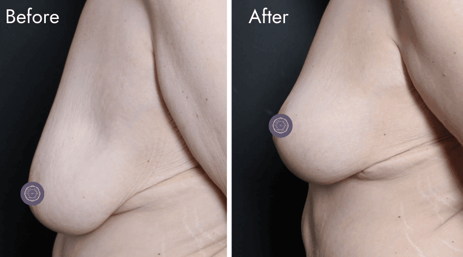 patient 7 before after