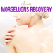 Morgellons Recovery