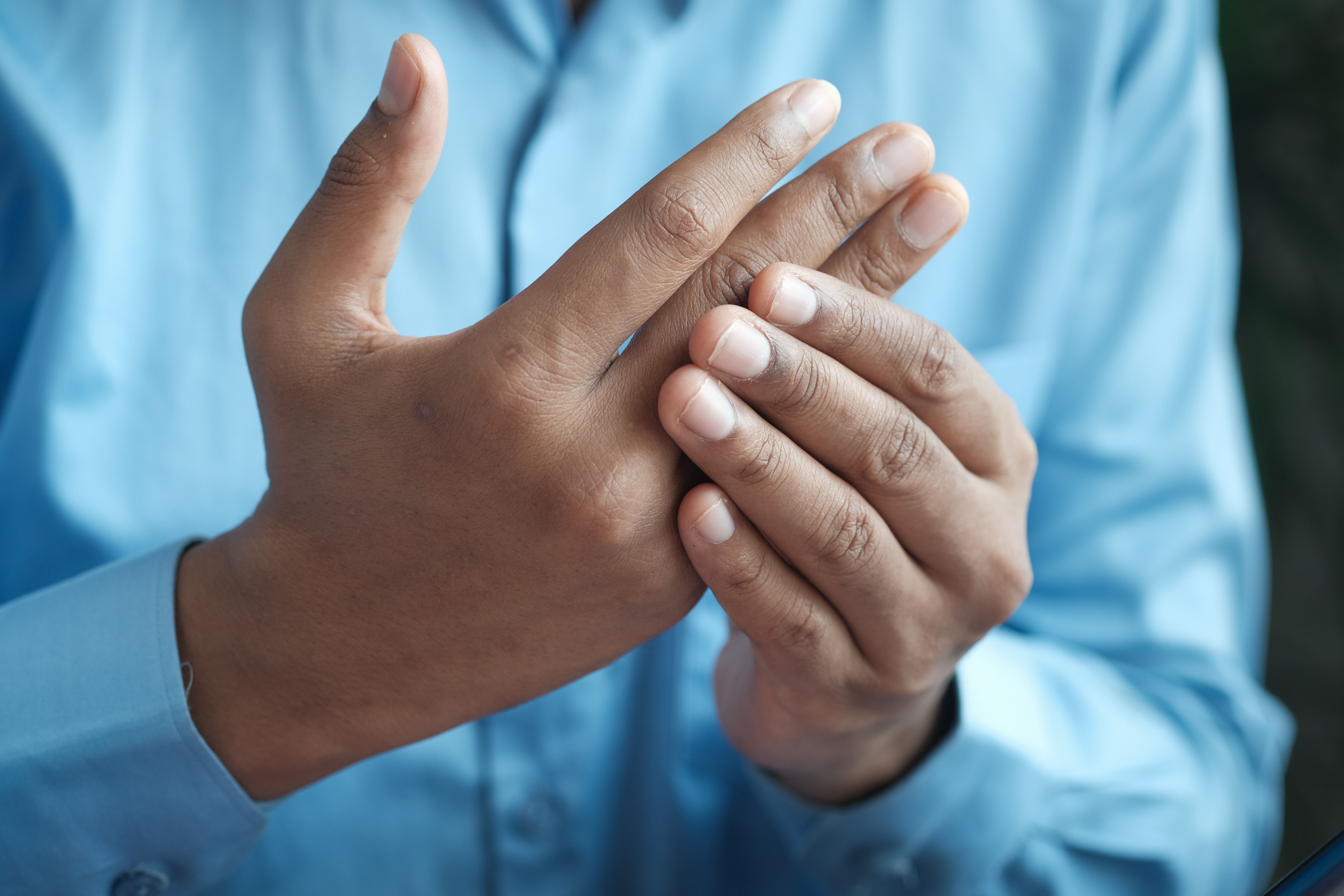 man holding arthritic hand 