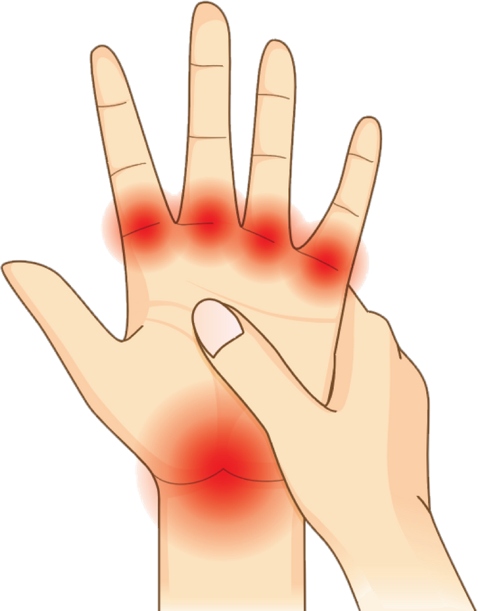 A Patient's Guide to Rheumatoid Arthritis Tests & Monitoring