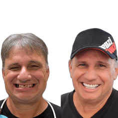 Donald Kelsey Dental Implants Before and After Transformation