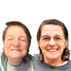 Terri Donahoe Dental Implants Before and After Transformation