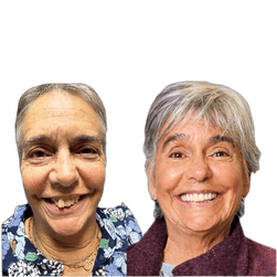 Lori Rose Dental Implants Before and After Transformation