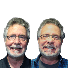 JW Hayes Dental Implants Before and After Transformation