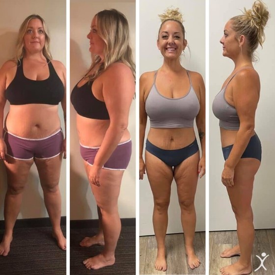Affordable Weight Loss Surgery in Tijuana Mexico Bariatric Center