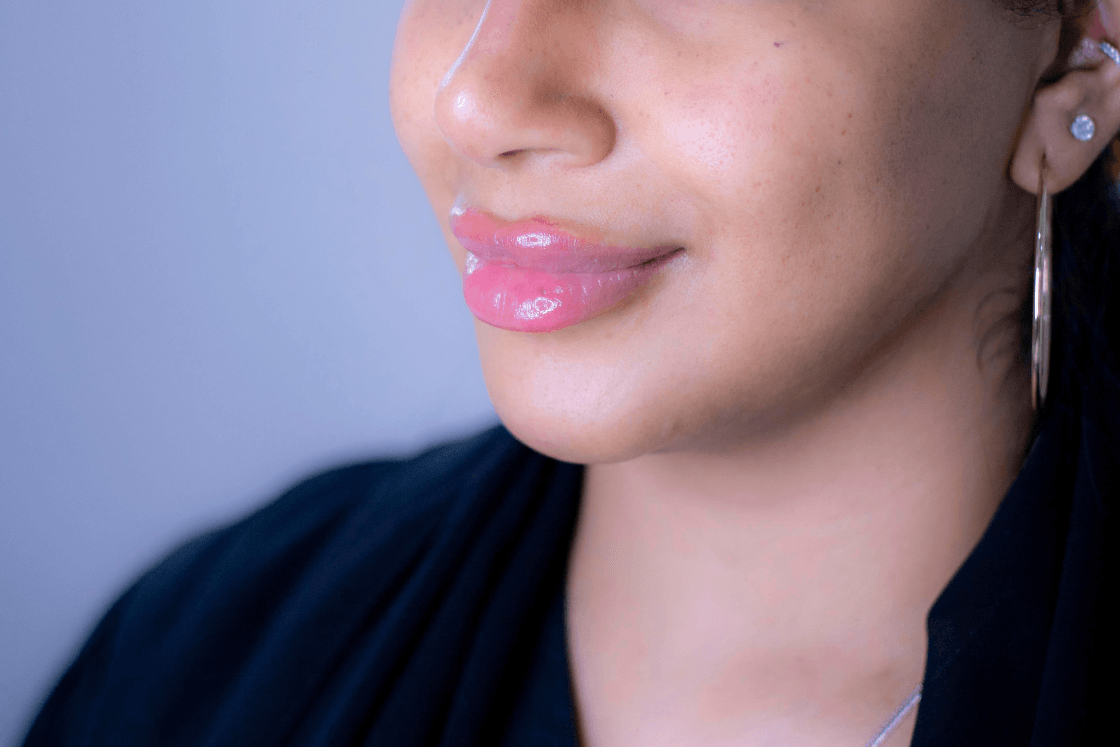 Dermal Filler Packages