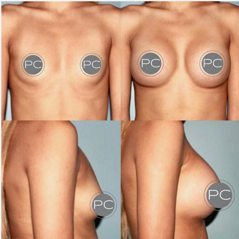 Before And After Photos
