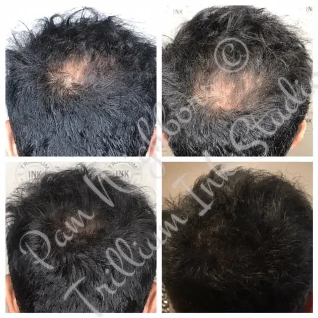 Before and after SMP on a thinning crown