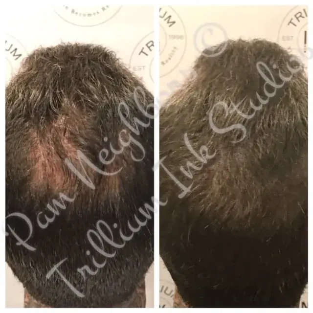 Before and after SMP on a thinning crown