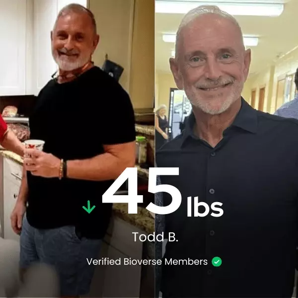 todd Before/After
