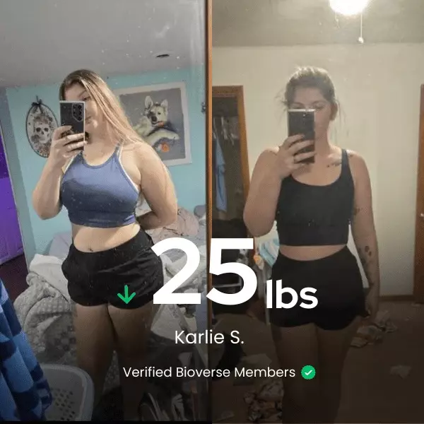 karlie Before/After