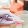 Image of a hand holding a petri dish.