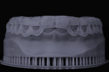 Gengivoplastia
