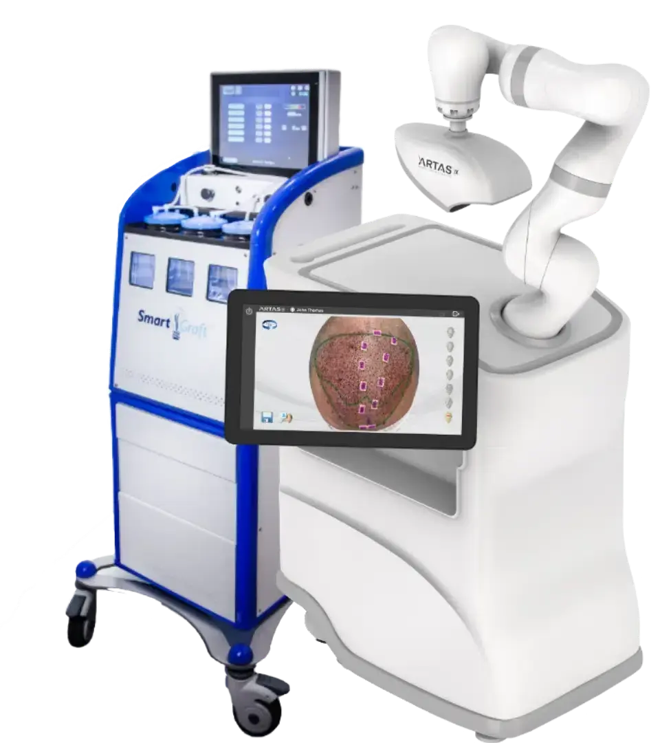 ARTAS Robot and SmartGraft