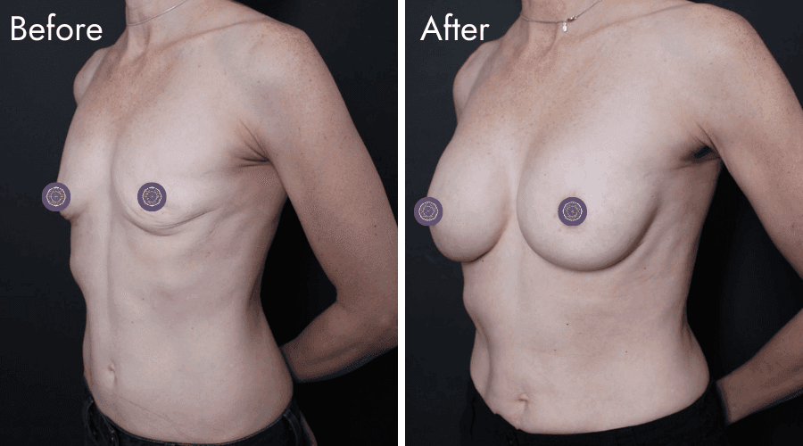 patient 3 before after