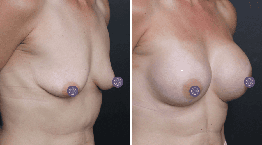 patient 8 before after