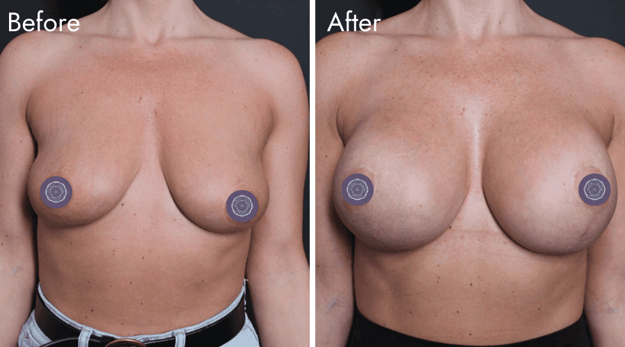 patient 10 before after