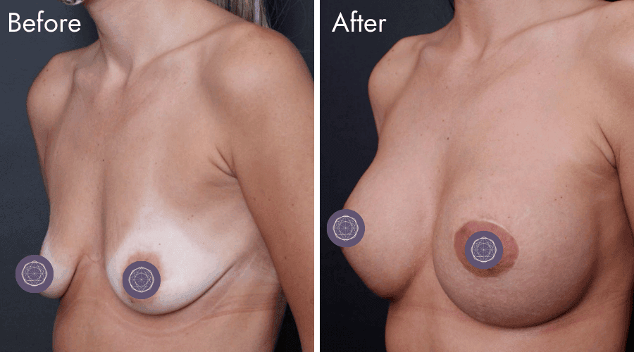 patient 11 before after