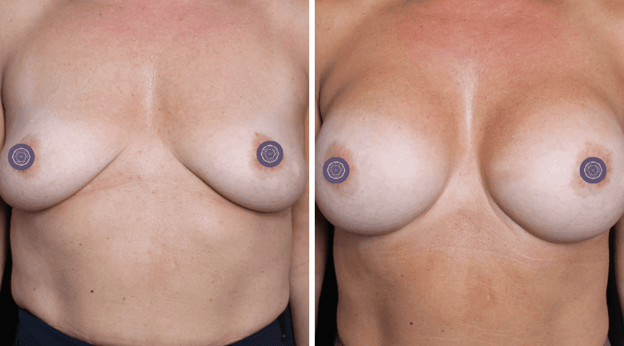 patient 5 before after