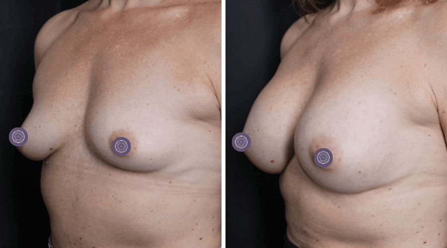 patient 6 before after