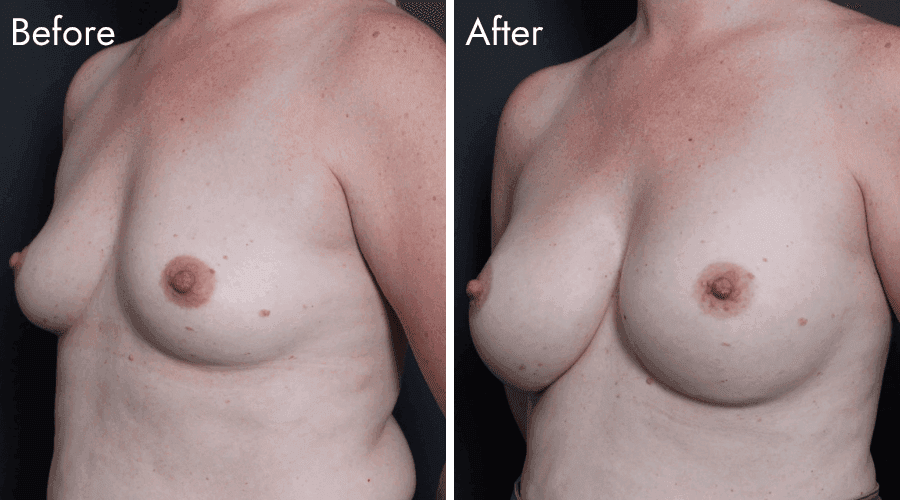 patient 1 before after