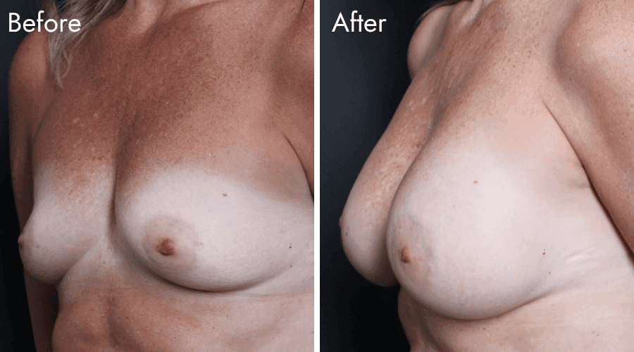 patient 1 before after