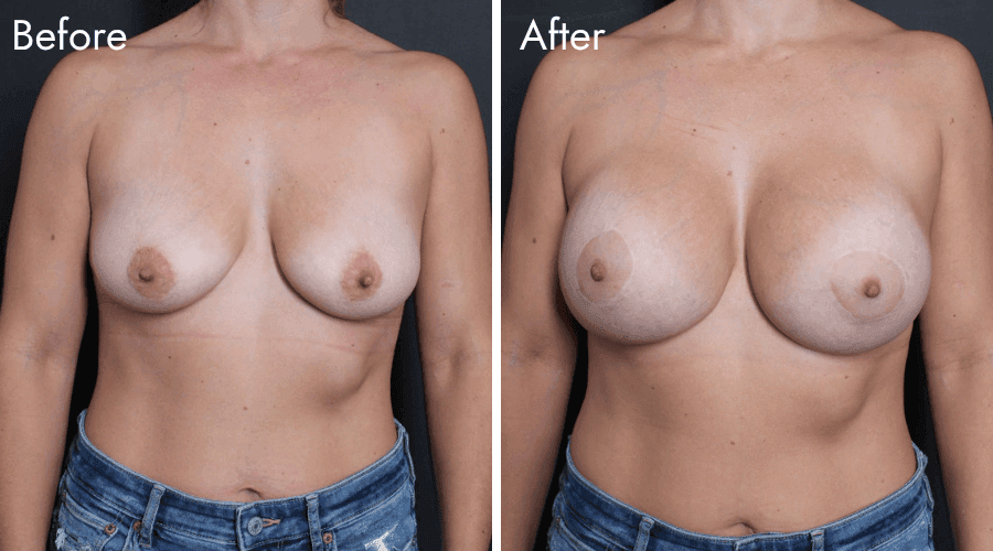 patient 1 before after
