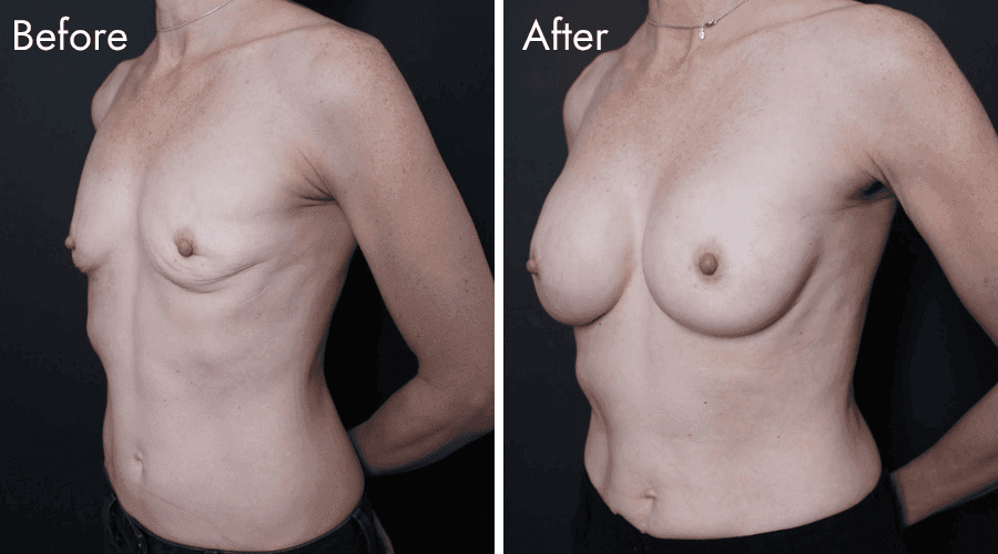 patient 1 before after