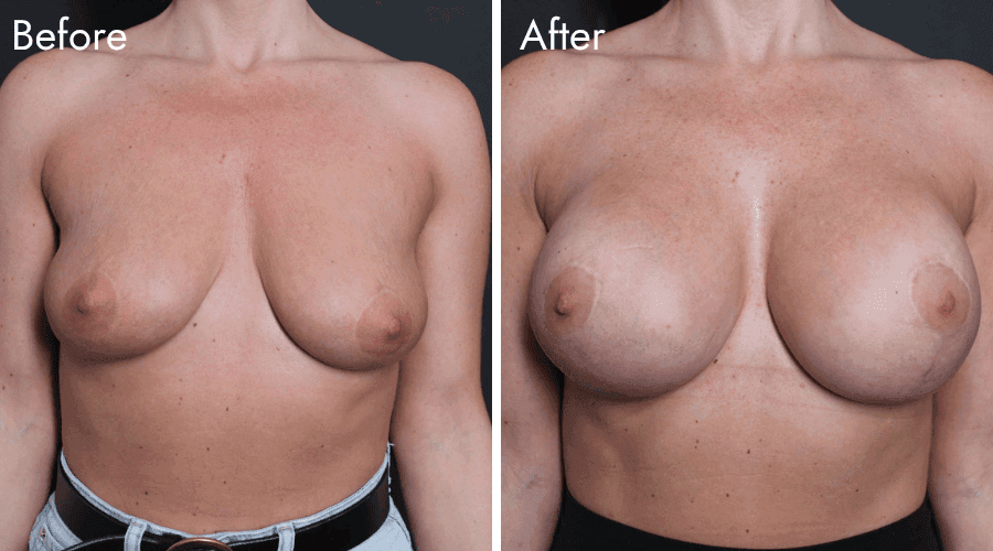 patient 1 before after