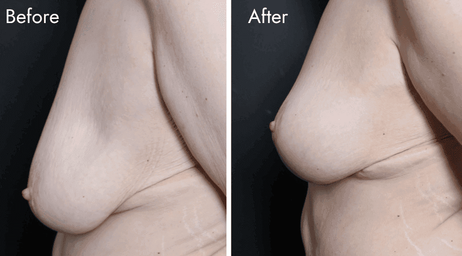 patient 1 before after
