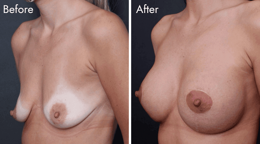 patient 1 before after