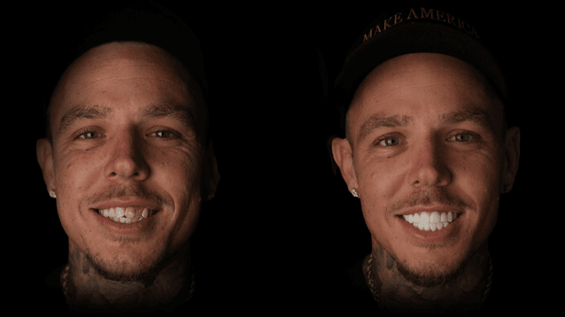 Smile 12