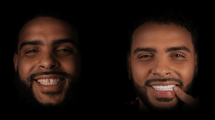 Smile 4
