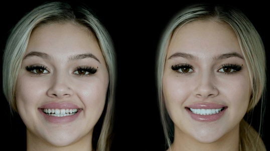 Smile 9