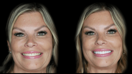 Smile 3